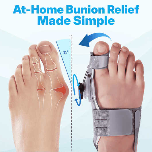 The Scalora BunionEase™ - Fix Your Bunion, Walk Pain-Free Again