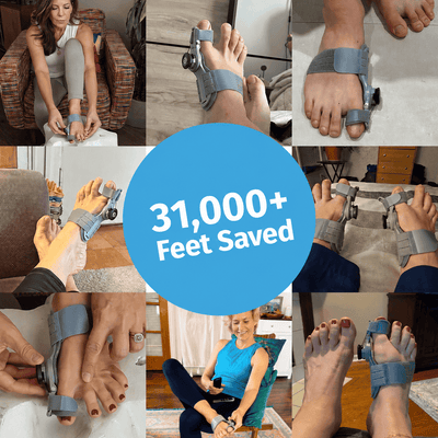 The Scalora BunionEase™ - Fix Your Bunion, Walk Pain-Free Again