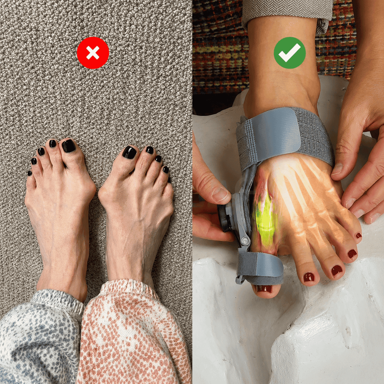 Here's what's actually happening to your toe